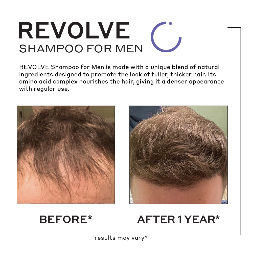 revolve shampoo for men before and after showing thicker hair after a year
