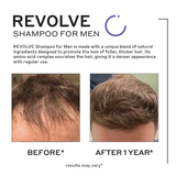 revolve shampoo for men before and after showing thicker hair after a year