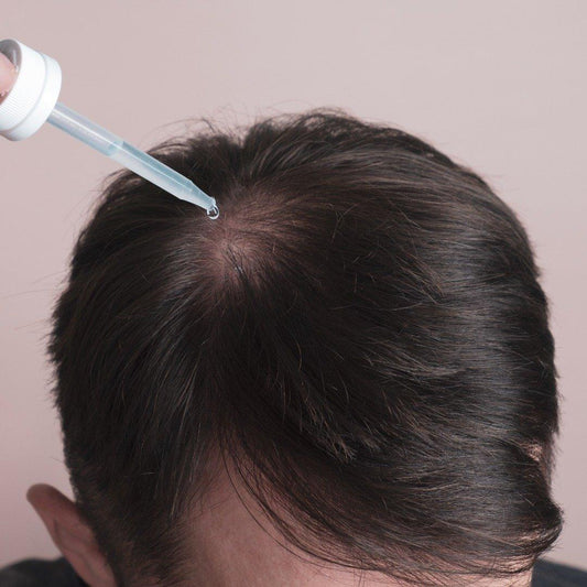 The Side Effects of Minoxidil You Need to Know About - Zenagen