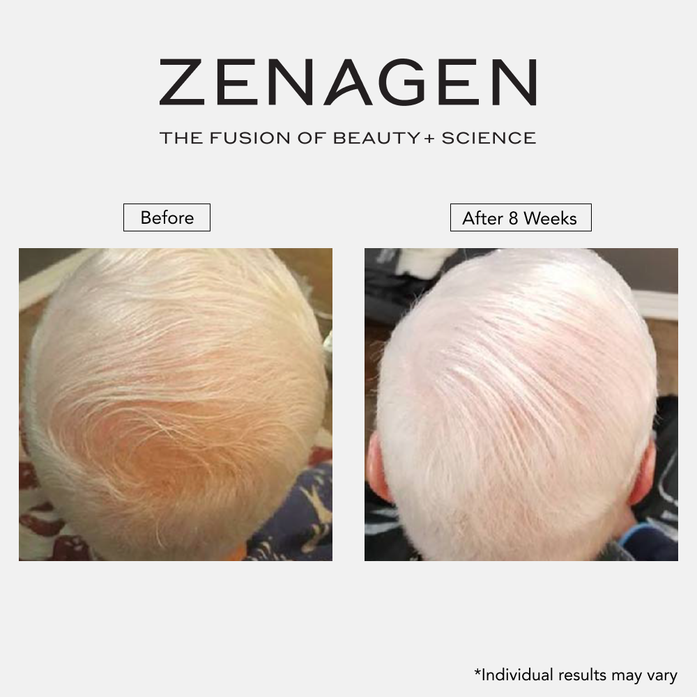 Revolve 6.75oz Men's Duo