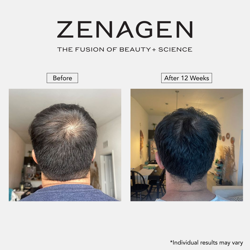 Revolve 6.75oz Men's Duo