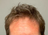 men's after image showing thicker fuller hair after 7 weeks