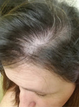 women's before picture showing thinning hair