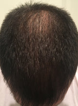 men's after image showing thicker fuller hair after 4 weeks