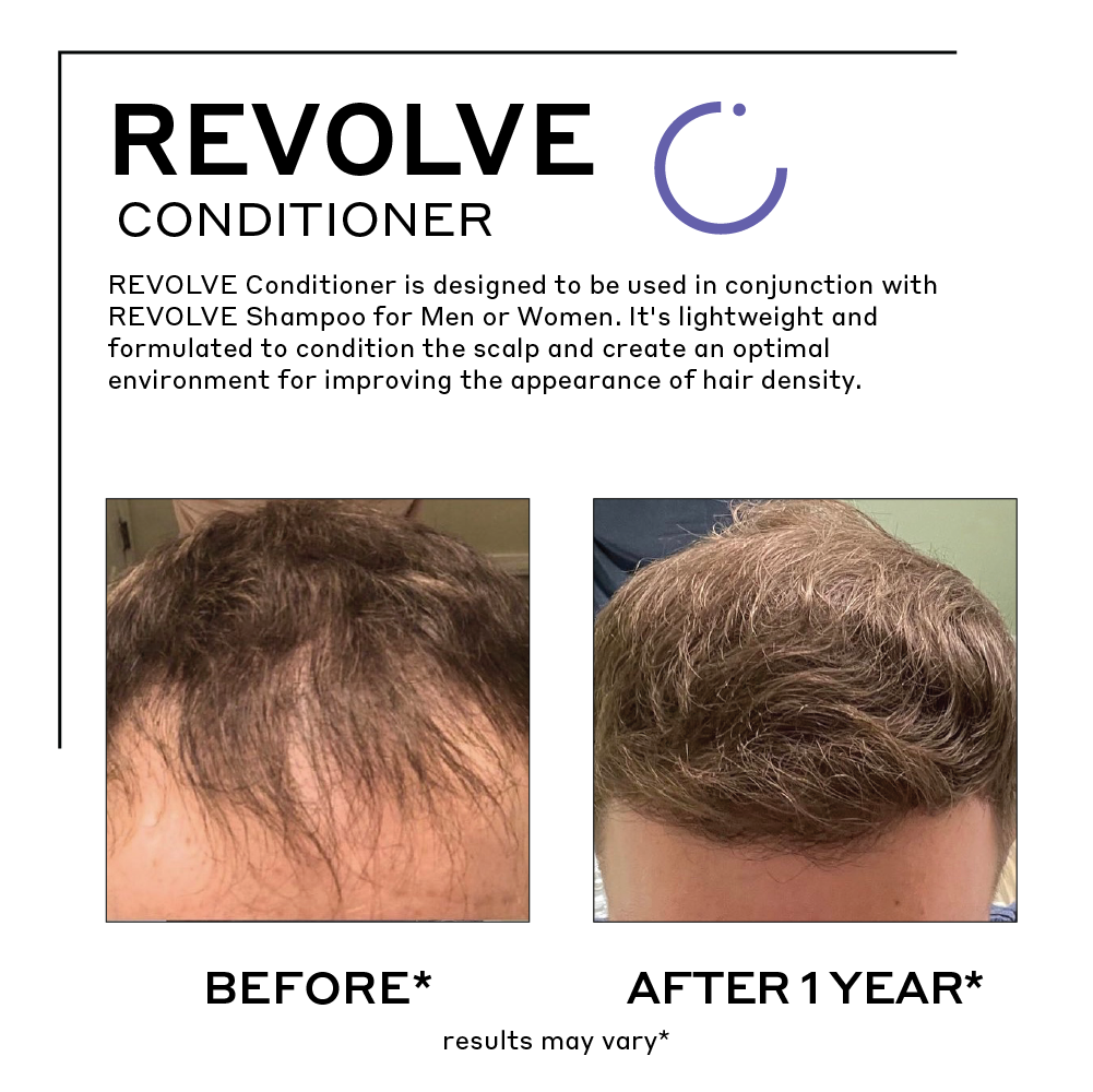 revolve conditioner before after photo showing thicker fuller hair after one year