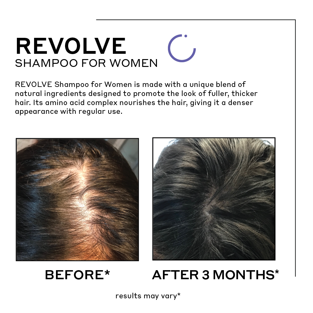 revolve for women before and after showing thicker fuller hair after a year
