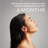 improved scalp health and visibly denser hair after six months