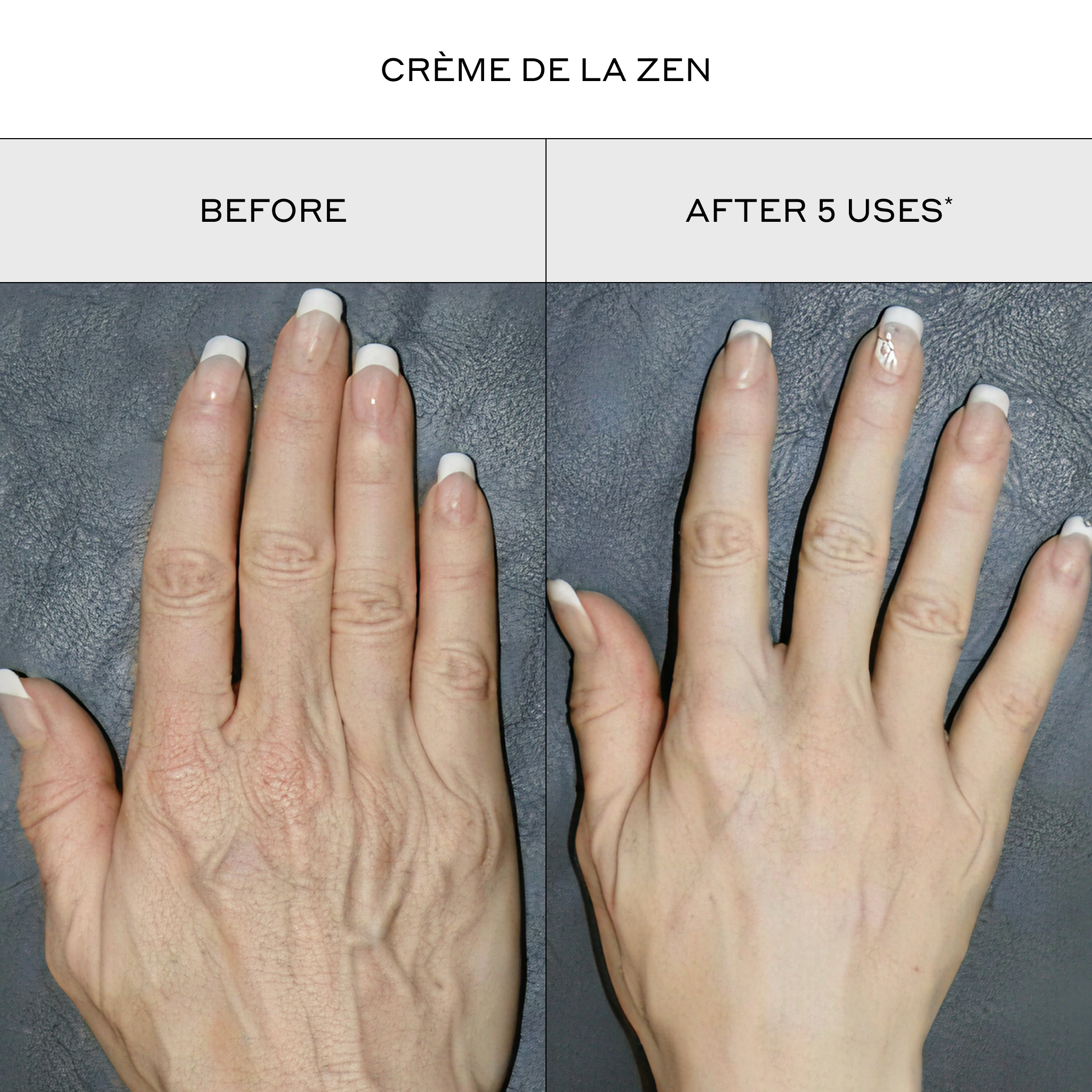 Zenagen Crème De La Zen before and after comparison image showing a top-down view of a hand, demonstrating a transformation from dry, deeply wrinkled skin with prominent fine lines to a visibly smoother, plumper, and more hydrated appearance with reduced texture after 5 uses.