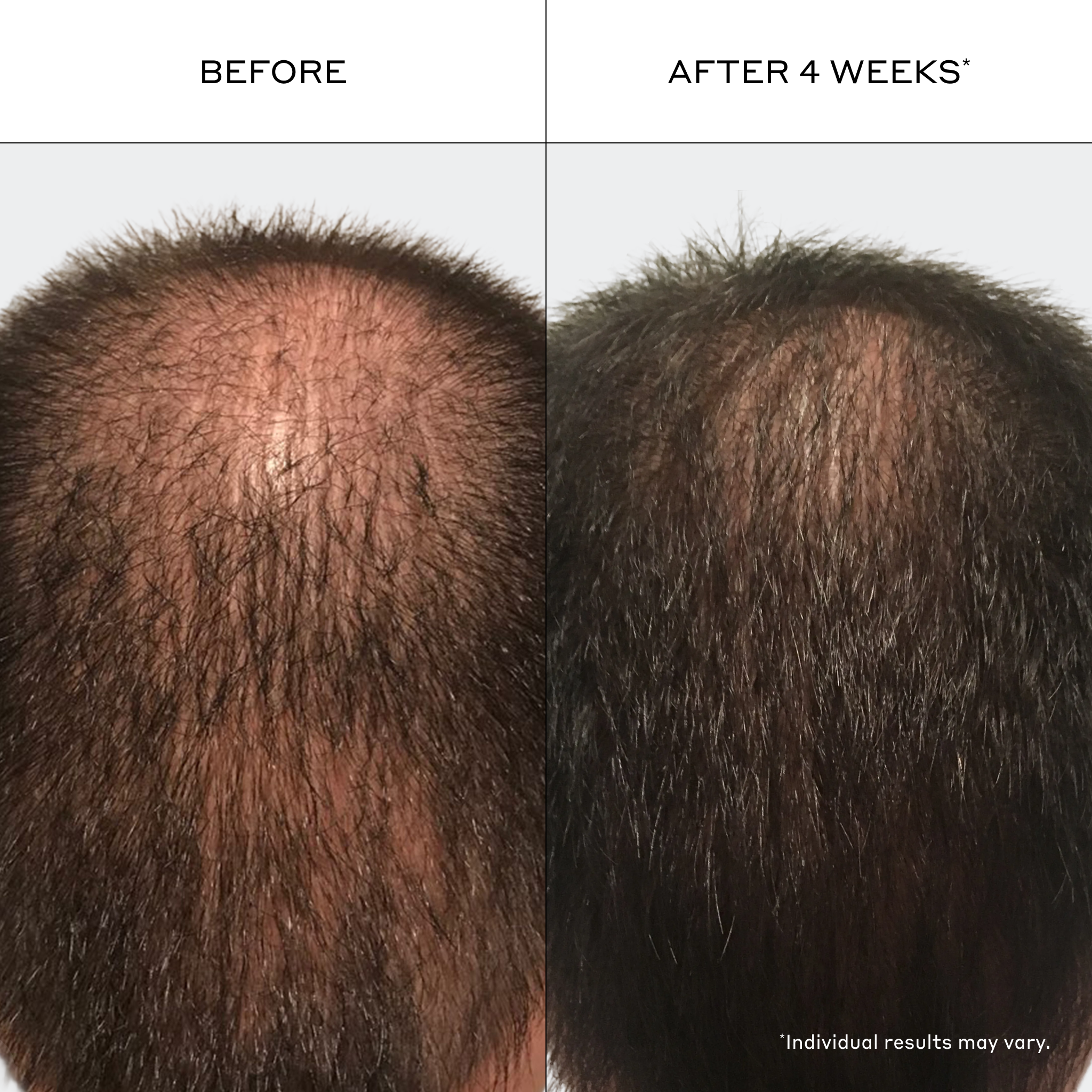 Men's Densifying Kit