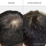 A side-by-side before-and-after comparison of a person's dark hair at the crown, showing thinning hair on the left ('BEFORE') and fuller, denser hair on the right ('AFTER 3 MONTHS').