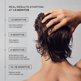 Zenagen Men's Revolve Shampoo and Conditioner results timeline infographic showing progress milestones from 1.5 months to optimal results at 12–18 months for healthier feel, visible hair density, and a balanced scalp with consistent use.