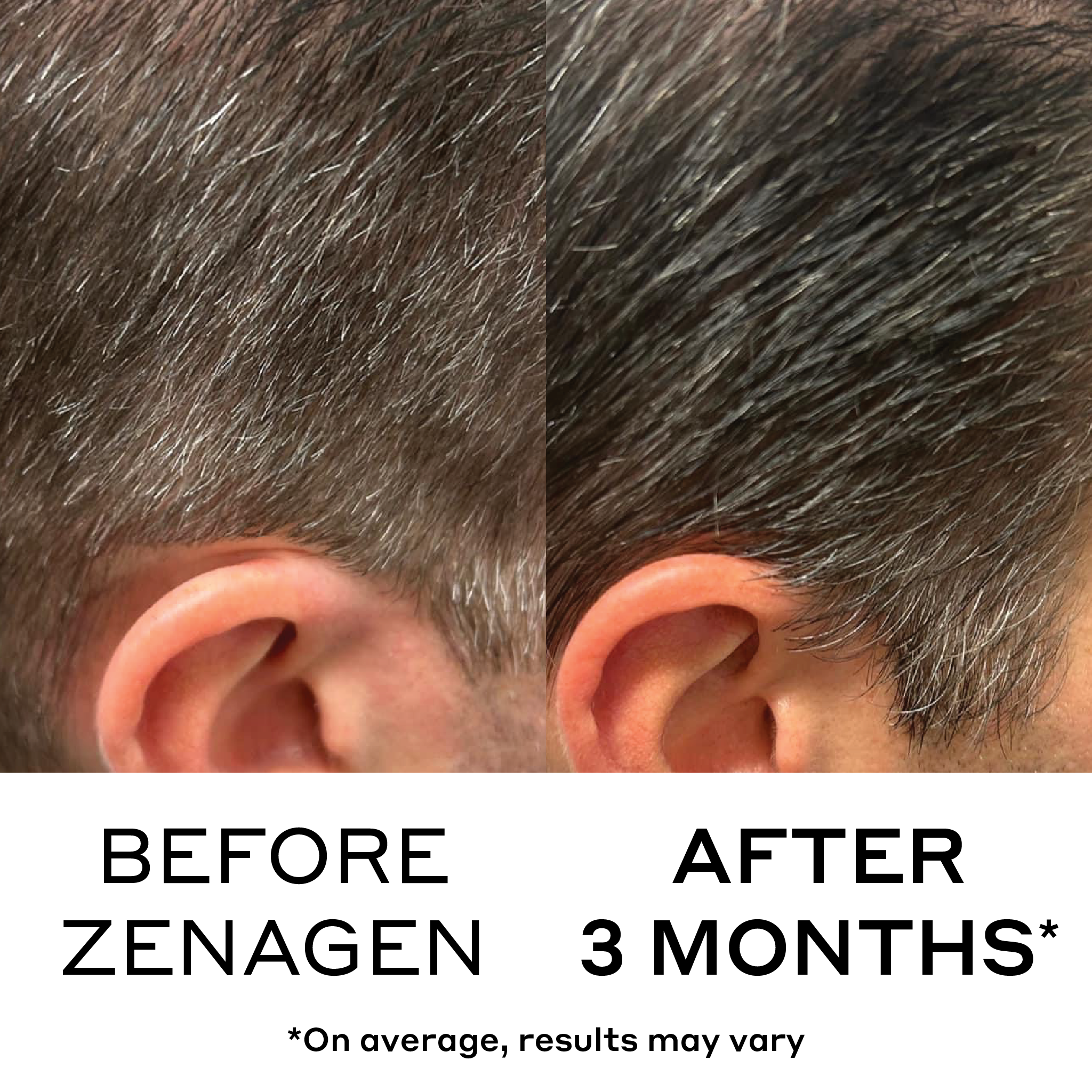 before and after showing three month results of less gray more vibrant hair from zenagen eclipse