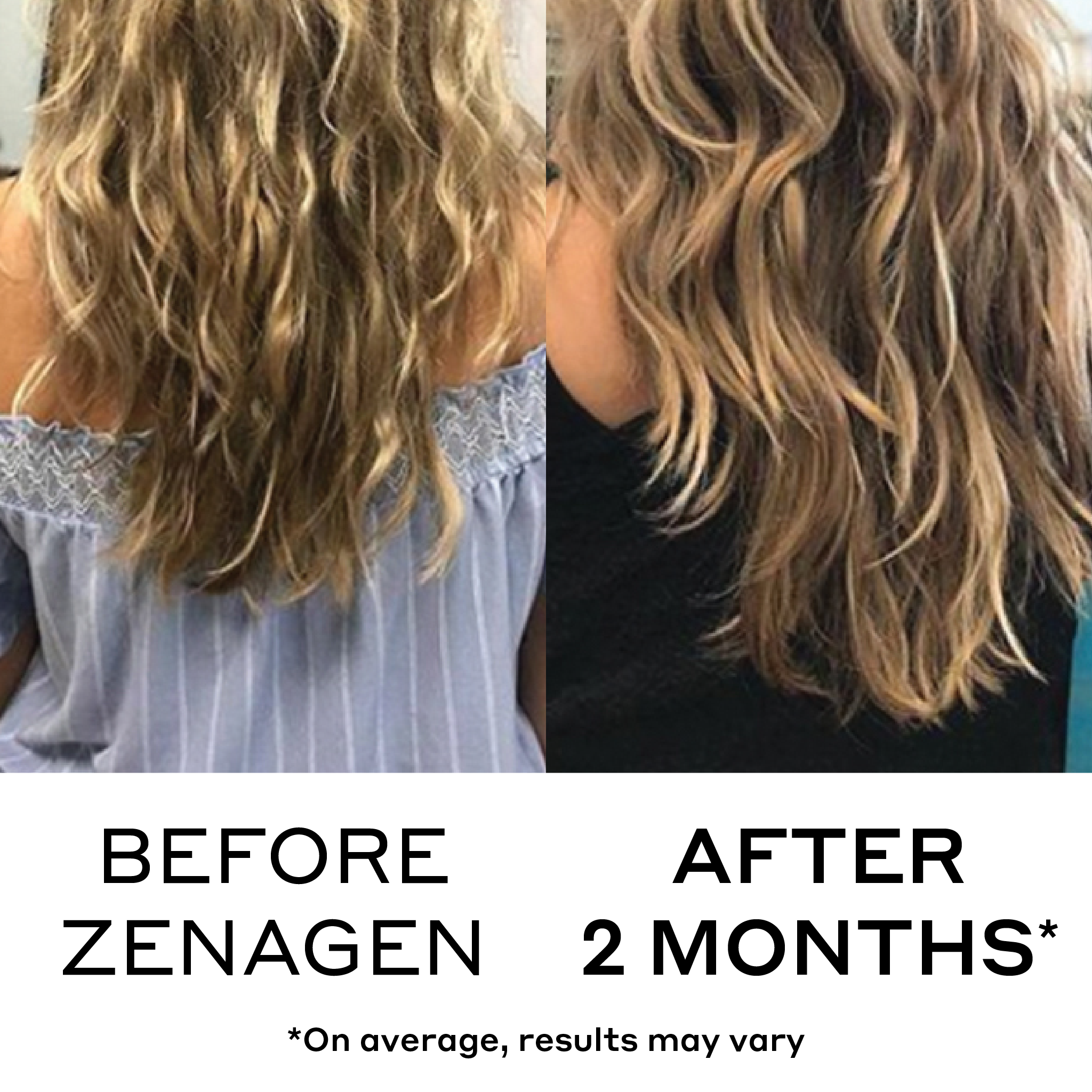 before and after showing two month hair growth results with zenagen evolve