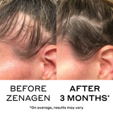 before and after showing results from zenagen revolve thicker hair