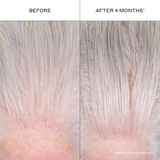 Before-and-after results showing fuller-looking, thicker-looking hair and improved hair density appearance with continued use of Zenagen Densifying Hair Serum.