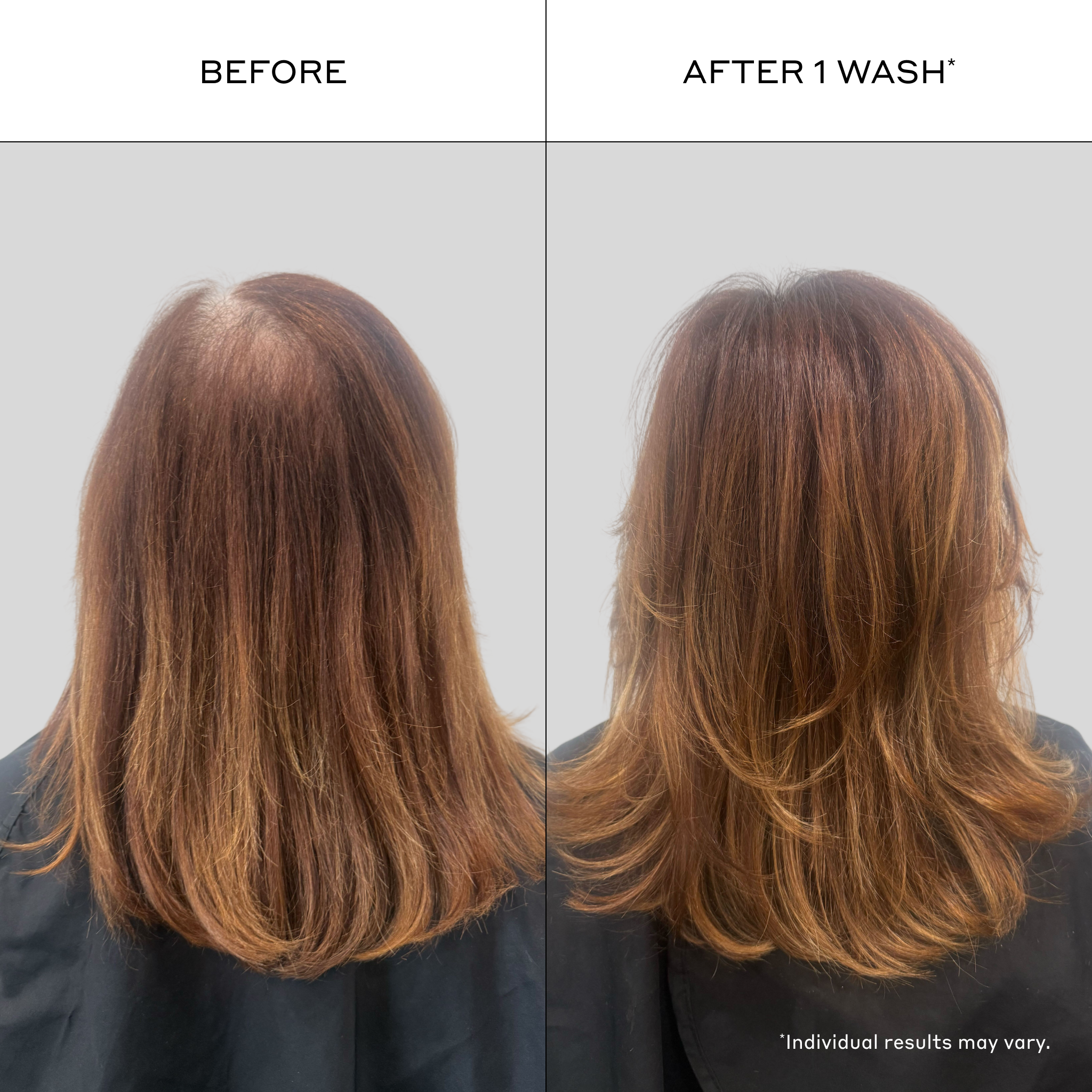 Woman with visibly thinning hair before and after using ZENAGEN Zenergy Daily Shampoo after one wash, showing fuller-looking volume, improved body, and healthier-looking shine. Side-by-side hair transformation for fine, thinning hair with instant cosmetic volumizing results.